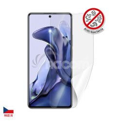 Screenshield Anti-Bacteria XIAOMI 11T folie na displej XIA-11TAB-D