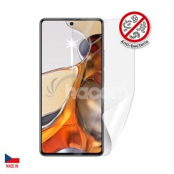 Screenshield Anti-Bacteria XIAOMI 11T Pro folie na displej XIA-11TPRAB-D