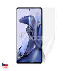 Screenshield XIAOMI 11T folie na displej XIA-11T-D