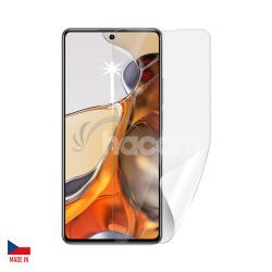 Screenshield XIAOMI 11T Pro folie na displej XIA-11TPR-D